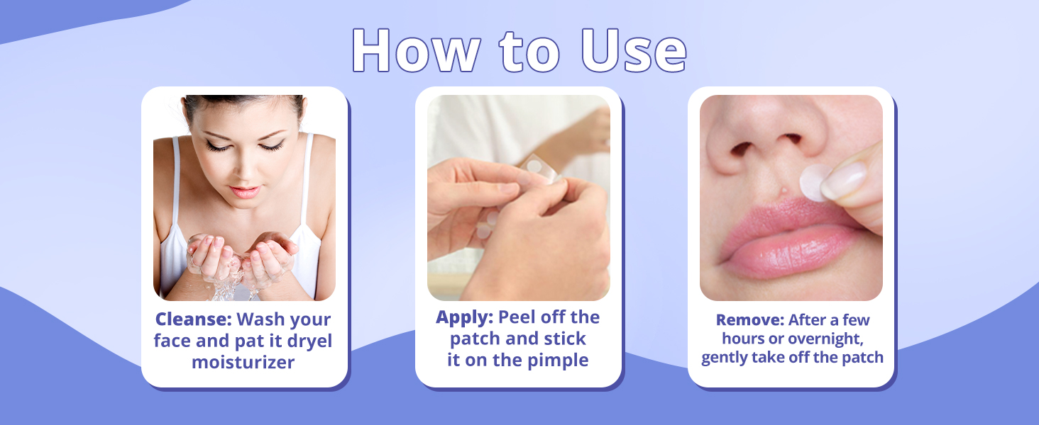 Erazer Acne Pimple Patches